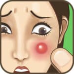 Pimple Popper Mobile app